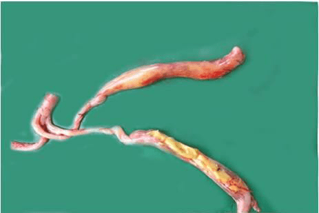 Digestive System of Poultry: How Birds Process and Absorb Nutrients