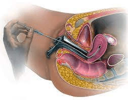 Natural Mating vs Artificial Insemination: Find out which is Better