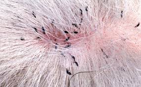Lice: Description, Damages Caused, Control and Preventive Measures