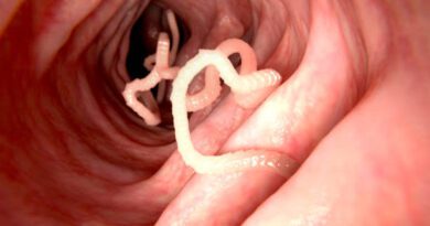 Hookworms: Description, Damages Caused, Control and Preventive Measures