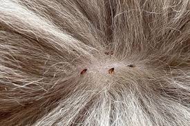 Lice: Description, Damages Caused, Control and Preventive Measures ...