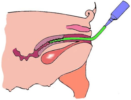 Artificial Insemination Techniques in Animal Breeding Artificial Insemination Techniques in Animal Breeding