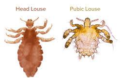 Poultry External Parasites and Control Measures
