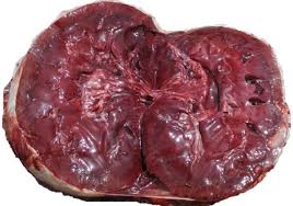 Pulpy Kidney Disease in Sheep and Goats