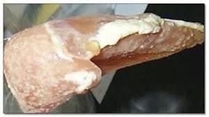 Microbial Spoilage in Butter and Poultry Products